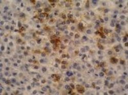 alpha-Fetoprotein/AFP Antibody (AFP-11) - BSA Free 0.1mg; Unlabeled:Antibodies,