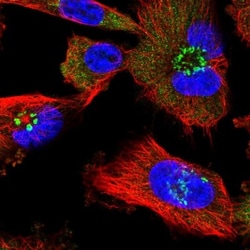 alpha 1 Mannosidase 1A Antibody, Novus Biologicals 25 &mu;L, Unlabeled:Antibodies,
