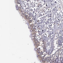 alpha 1-Microglobulin Antibody, Novus Biologicals 25 &mu;L; Unlabeled:Antibodies,