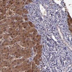 Serpin F2/alpha 2-Antiplasmin Antibody, Novus Biologicals 0.1mL; Unlabeled:Antibodies,
