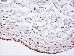 alpha-Actinin 1 Antibody (OTI7A4), Novus Biologicals 0.1mL; Unlabeled:Antibodies,