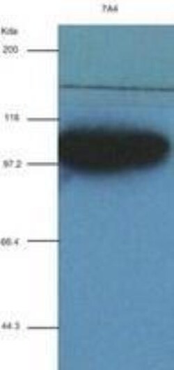 alpha-Actinin 1 Antibody (OTI7A4), Novus Biologicals 0.1mL; Unlabeled:Antibodies,