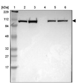 alpha-Actinin 1 Antibody, Novus Biologicals 0.1mL; Unlabeled:Antibodies,