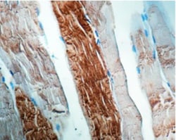 Alpha Actinin 2 Antibody (EA-53), Novus Biologicals:Antibodies:Primary