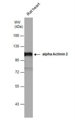 Alpha Actinin 2 Antibody, Novus Biologicals 0.1mL; Unlabeled:Antibodies,