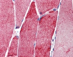 Alpha Actinin 3 Antibody, Novus Biologicals 0.05mg; Unlabeled:Antibodies,