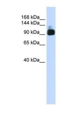 Alpha Actinin 3 Antibody, Novus Biologicals 0.05mg; Unlabeled:Antibodies,