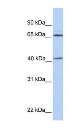 alpha-Galactosidase A/GLA Antibody, Novus Biologicals 0.05mg; Unlabeled:Antibodies,
