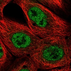 alpha Glucosidase 2 Antibody, Novus Biologicals 25 &mu;L; Unlabeled:Antibodies,