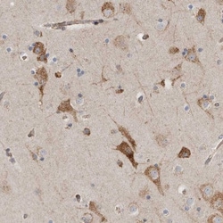 alpha Glucosidase 2 Antibody, Novus Biologicals 25 &mu;L; Unlabeled:Antibodies,