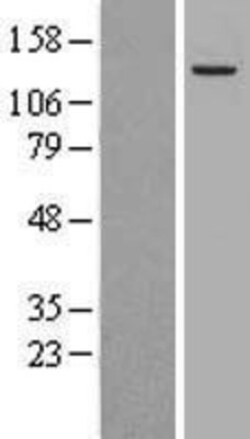 Novus Biologicals&trade;&nbsp;Alpha-mannosidase II Overexpression Lysate
