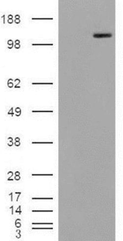 Alpha-mannosidase II Antibody, Novus Biologicals 0.1mg; Unlabeled:Antibodies,