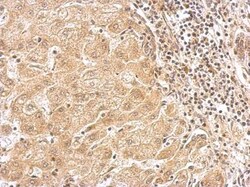 alpha-N-acetylglucosaminidase/NAGLU Antibody, Novus Biologicals 0.1mg;