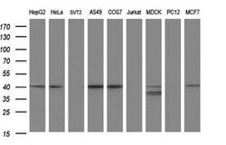 Alpha-parvin/Actopaxin Antibody (OTI1C10), Novus Biologicals 0.1mL; Unlabeled:Antibodies,