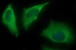 Alpha-parvin/Actopaxin Antibody (OTI1C10), Novus Biologicals 0.1mL; Unlabeled:Antibodies,