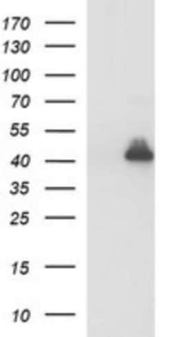 Alpha-parvin/Actopaxin Antibody (OTI1C10), Novus Biologicals 0.1mL; Unlabeled:Antibodies,
