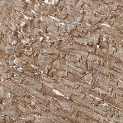 alpha-Sarcoglycan Antibody, Novus Biologicals 0.1mL; Unlabeled:Antibodies,
