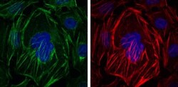alpha-Smooth Muscle Actin Antibody (4A4), Novus Biologicals:Antibodies:Primary