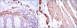 alpha-Smooth Muscle Actin Antibody (4A4), Novus Biologicals:Antibodies:Primary