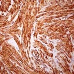 alpha-Smooth Muscle Actin Antibody, Novus Biologicals 500 &mu;L | Buy Online | Novus Biologicals | Fisher Scientific
