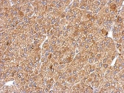 alpha-Smooth Muscle Actin Antibody, Novus Biologicals 0.1mg; Unlabeled:Antibodies,