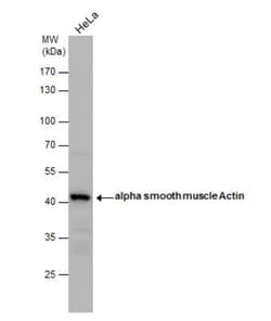 alpha-Smooth Muscle Actin Antibody, Novus Biologicals 0.1mg; Unlabeled:Antibodies,