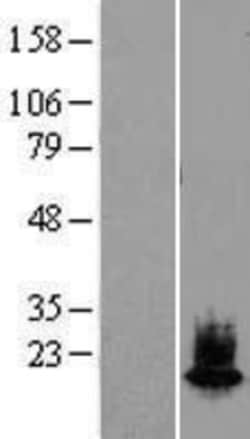 Novus Biologicals&trade;&nbsp;alpha-Synuclein Overexpression Lysate