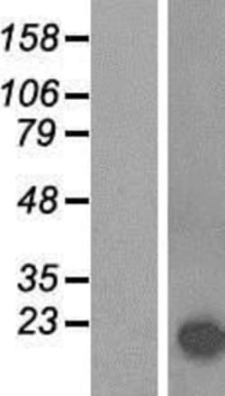Novus Biologicals&trade;&nbsp;alpha-Synuclein Overexpression Lysate