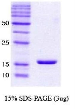 Novus Biologicals™ Recombinant Human alpha-Synuclein Protein