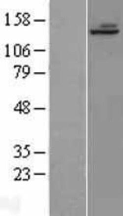 Novus Biologicals&trade;&nbsp;ALPK1 Overexpression Lysate