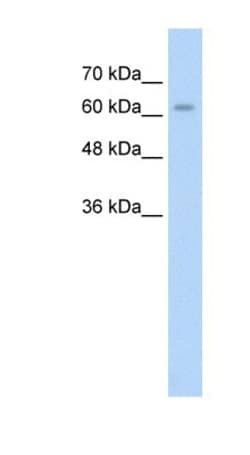 ALPPL2 Antibody, Novus Biologicals 100&mu;L; Unlabeled:Antibodies, Polyclonal