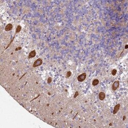 Als2 Antibody, Novus Biologicals 25 &mu;L, Unlabeled:Antibodies, Polyclonal