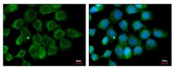 ALS2CR12 Antibody, Novus Biologicals 0.1mL; Unlabeled:Antibodies, Polyclonal