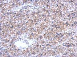 ALS2CR12 Antibody, Novus Biologicals 0.1mL; Unlabeled:Antibodies, Polyclonal