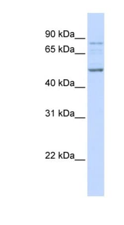 ALS2CR12 Antibody, Novus Biologicals 20&mu;L; Unlabeled:Antibodies, Polyclonal