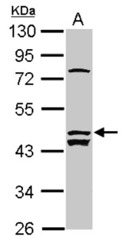 ALS2CR12 Antibody, Novus Biologicals 0.1mL; Unlabeled:Antibodies, Polyclonal