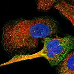 ALS2CR12 Antibody, Novus Biologicals 0.1mL; Unlabeled:Antibodies, Polyclonal