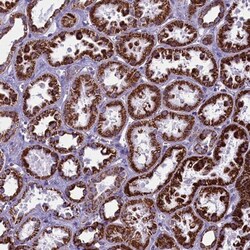 ALS2CR15 Antibody, Novus Biologicals 0.1mL; Unlabeled:Antibodies, Polyclonal