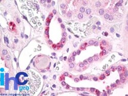 ALS2CR2 Antibody, Novus Biologicals:Antibodies:Primary Antibodies