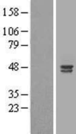 Novus Biologicals&trade;&nbsp;ALS2CR4 Overexpression Lysate