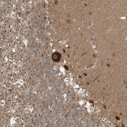 ALS2CR8 Antibody, Novus Biologicals 0.1mL; Unlabeled:Antibodies, Polyclonal