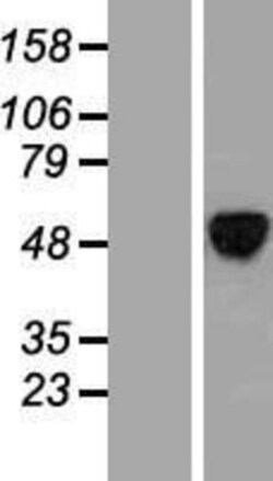Novus Biologicals&trade;&nbsp;ALX4 Overexpression Lysate