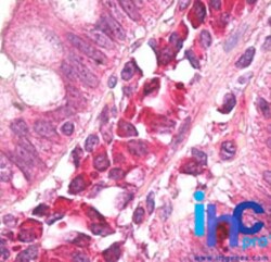 AMBRA1 Antibody, Novus Biologicals 0.1mg; Unlabeled:Antibodies, Polyclonal