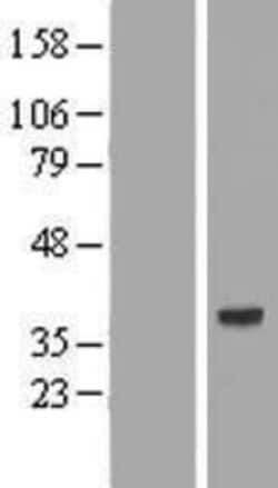 Novus Biologicals&trade;&nbsp;AMD1 Overexpression Lysate