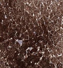 AMDHD1 Antibody, Novus Biologicals 0.1mL; Unlabeled:Antibodies, Polyclonal