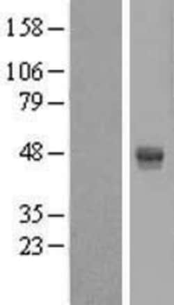 Novus Biologicals™ AMDHD2 Overexpression Lysate