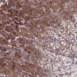 AMDHD2 Antibody, Novus Biologicals:Antibodies:Primary Antibodies