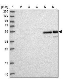 AMDHD2 Antibody, Novus Biologicals:Antibodies:Primary Antibodies