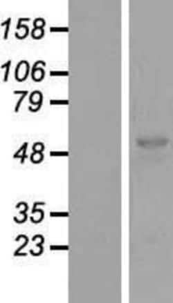 Novus Biologicals&trade;&nbsp;MIS/AMH Overexpression Lysate