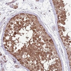 AMIGO Antibody, Novus Biologicals 0.1mL; Unlabeled:Antibodies, Polyclonal